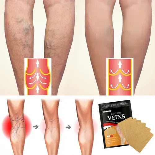 3x1 Parches Anti-Varices